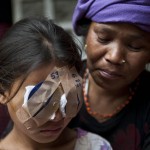 Help Cure Blindness